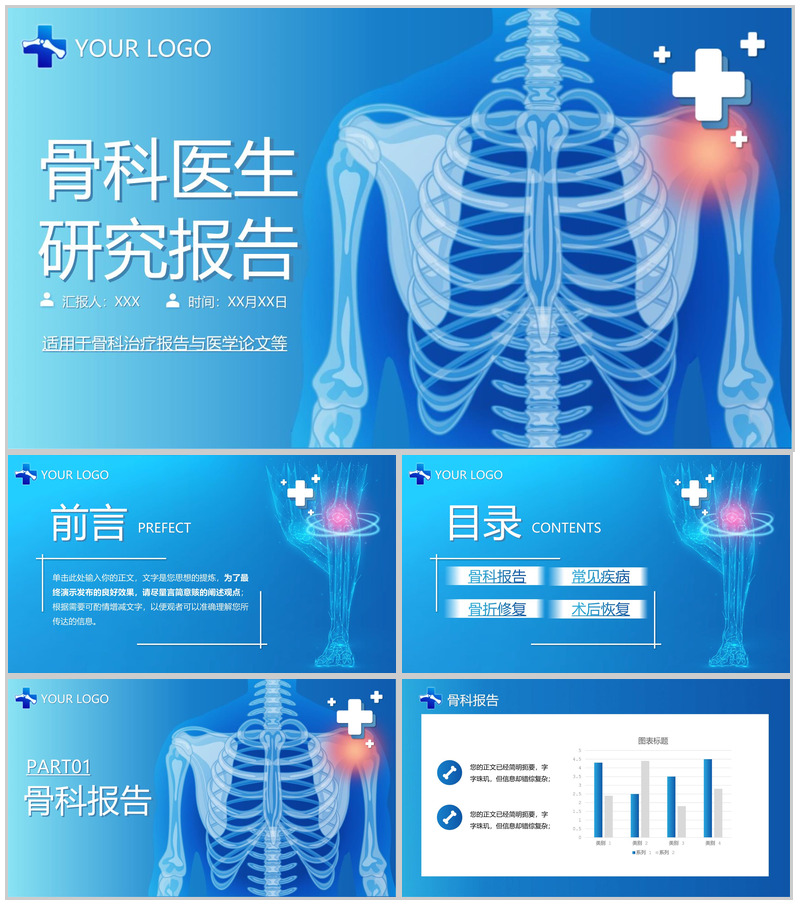 蓝色简洁骨科医生治疗研究报告医学论文答辩PPT模板-办公资源网